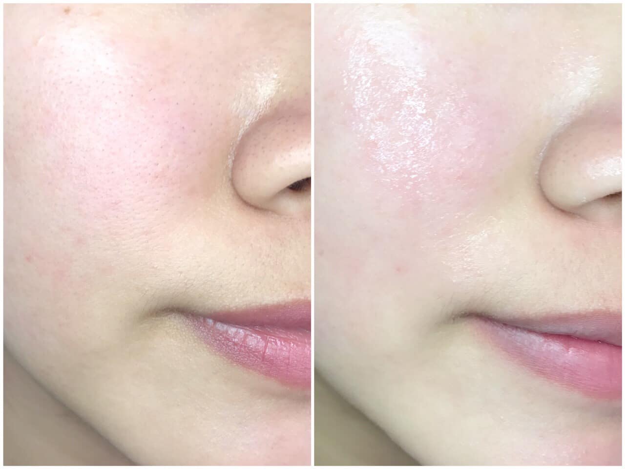 Tinh chất cấp ẩm và ngăn ngừa lão hóa Eucerin Hyaluron- Filler Moisture Booster Tinh chất cấp ẩm và ngăn ngừa lão hóa Eucerin Hyaluron- Filler Moisture Booster