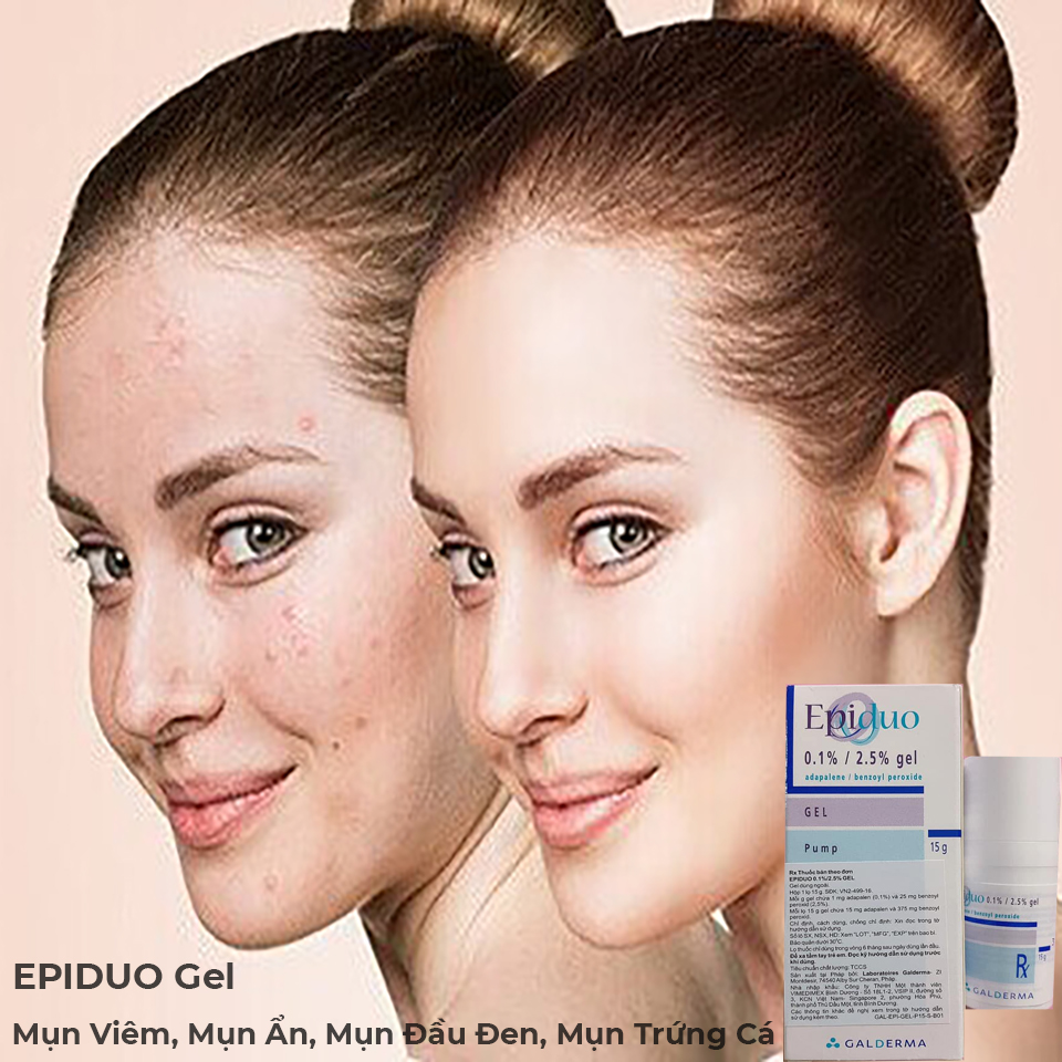 Kem Trị Mụn Epiduo Gel Galderma Kem Trị Mụn Epiduo Gel Galderma
